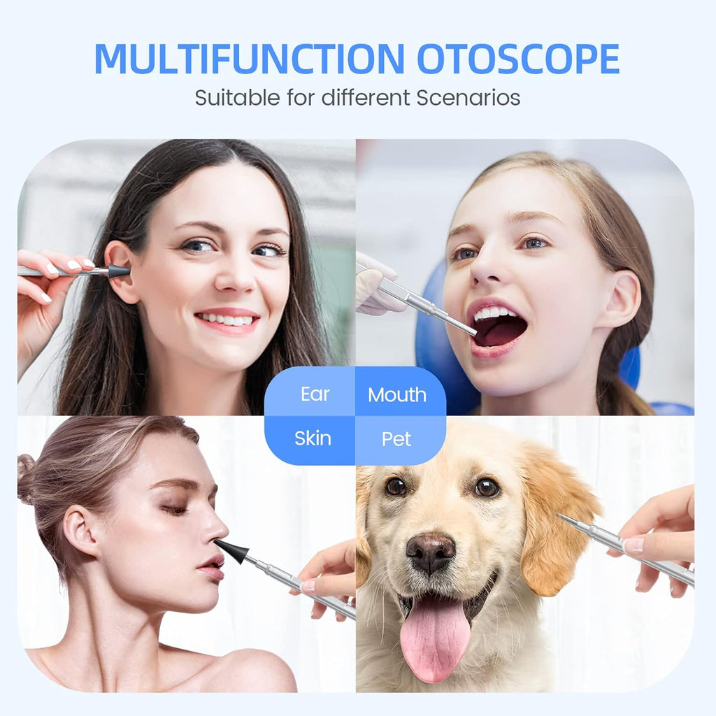 Otoscope Ear Cleaning Camera 1080P HD with IPS Screen and 32G Card A39255