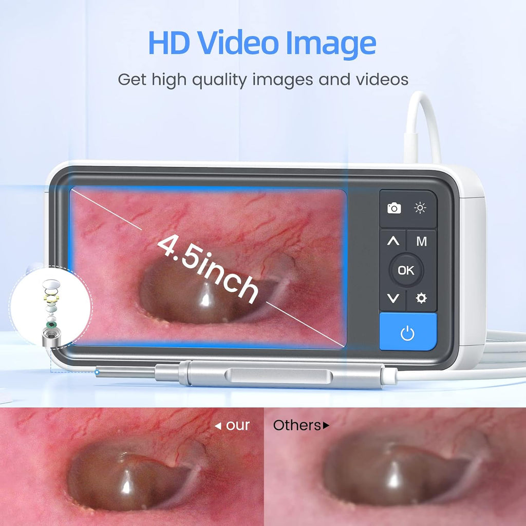 Otoscope Ear Cleaning Camera 1080P HD with IPS Screen and 32G Card A39255