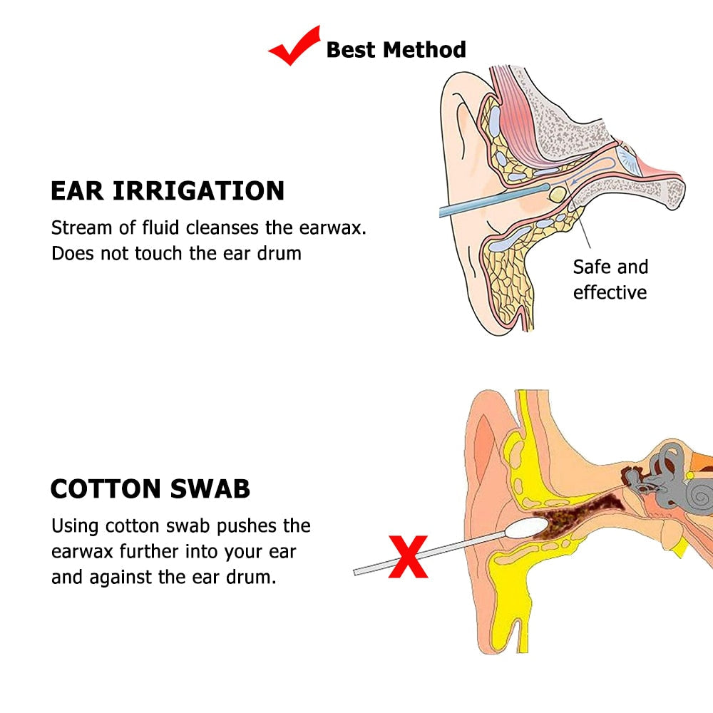 Ear Cleaner with Wax Removal Irrigator A6025